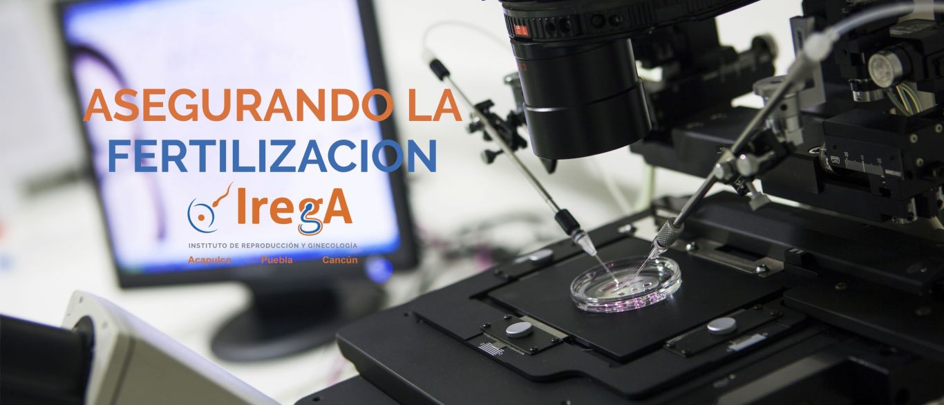 Fertilización irega