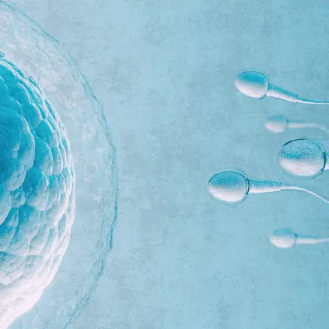 Inseminación Artificial